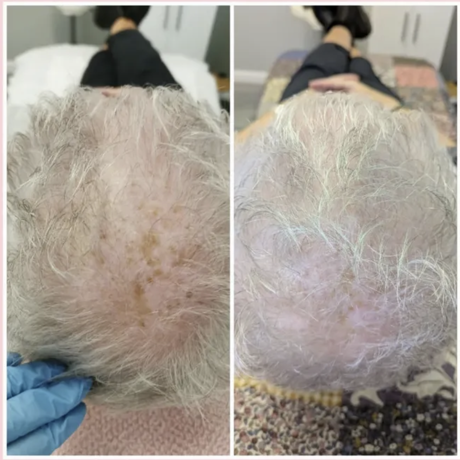Before and After Treatment Result 3