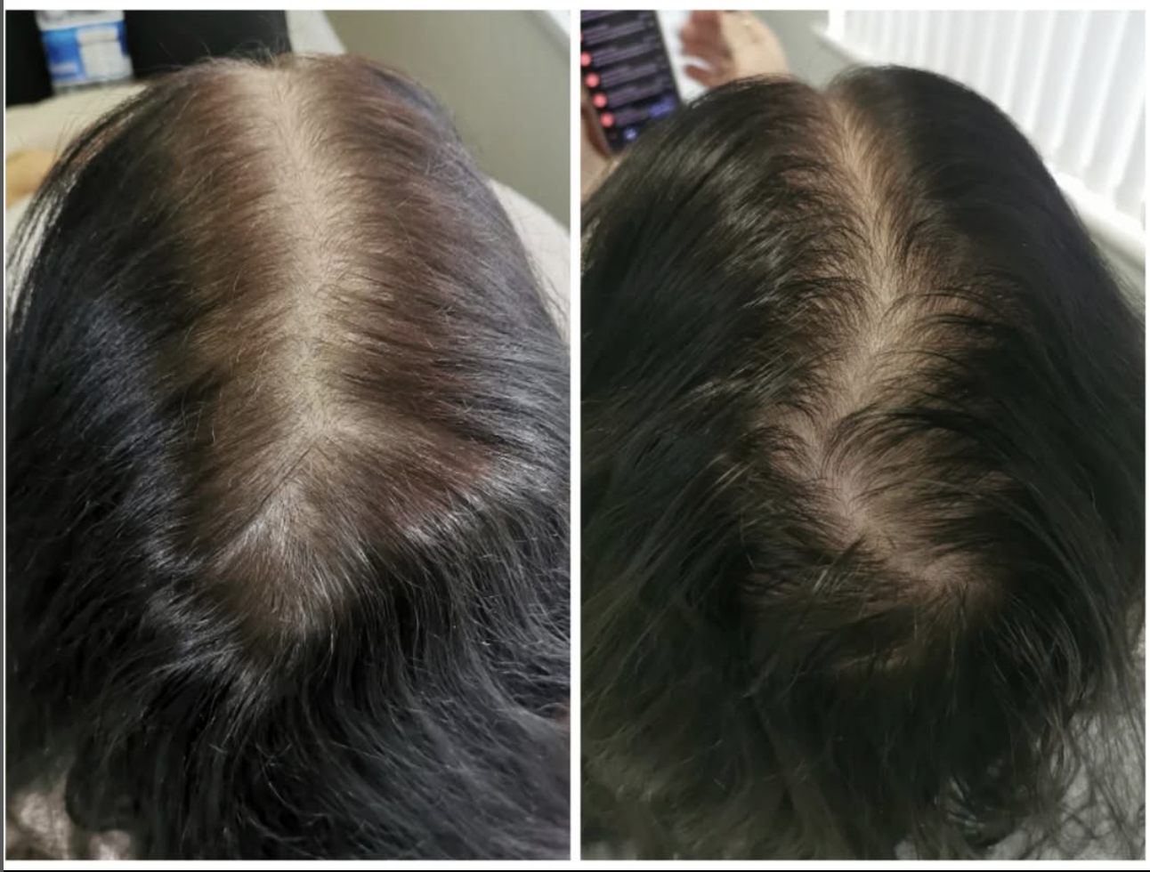 Before and After Treatment Result 6