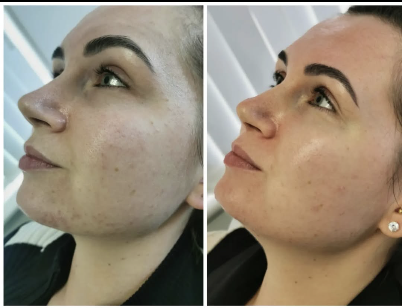 Before and After Treatment Result 8