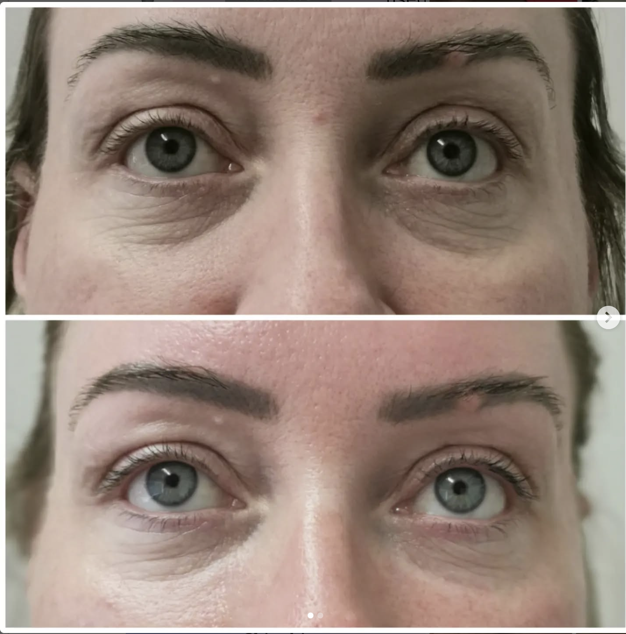 Before and After Treatment Result 10